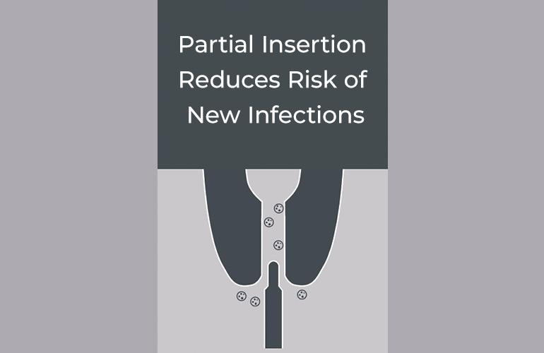 Partial insertion reduces risk of new infections
