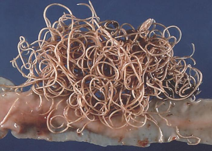 A mass of roundworms on tissue