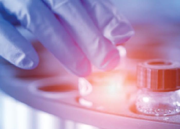 A gloved hand reaches for a vial