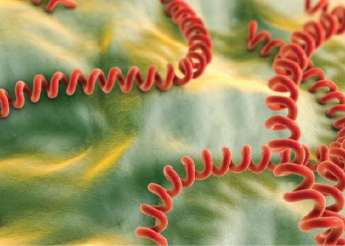 Image of leptospirosis