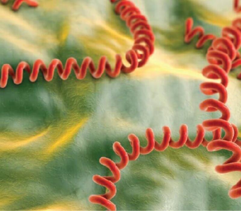 Image of leptospirosis